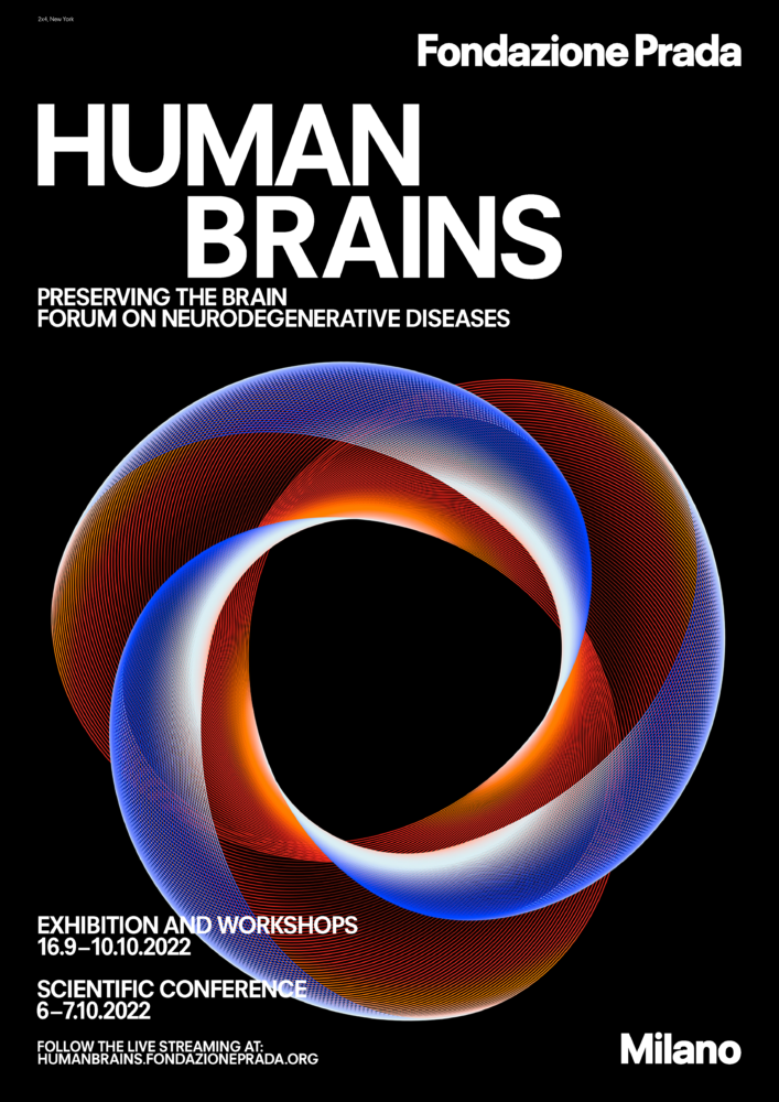 Human Brains: Preserving the Brain. Forum on Neurodegenerative Diseases |  European Charcot Foundation